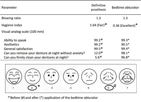 Application Of A Bedtime Obturator Prosthesis For An Edentulous Patient