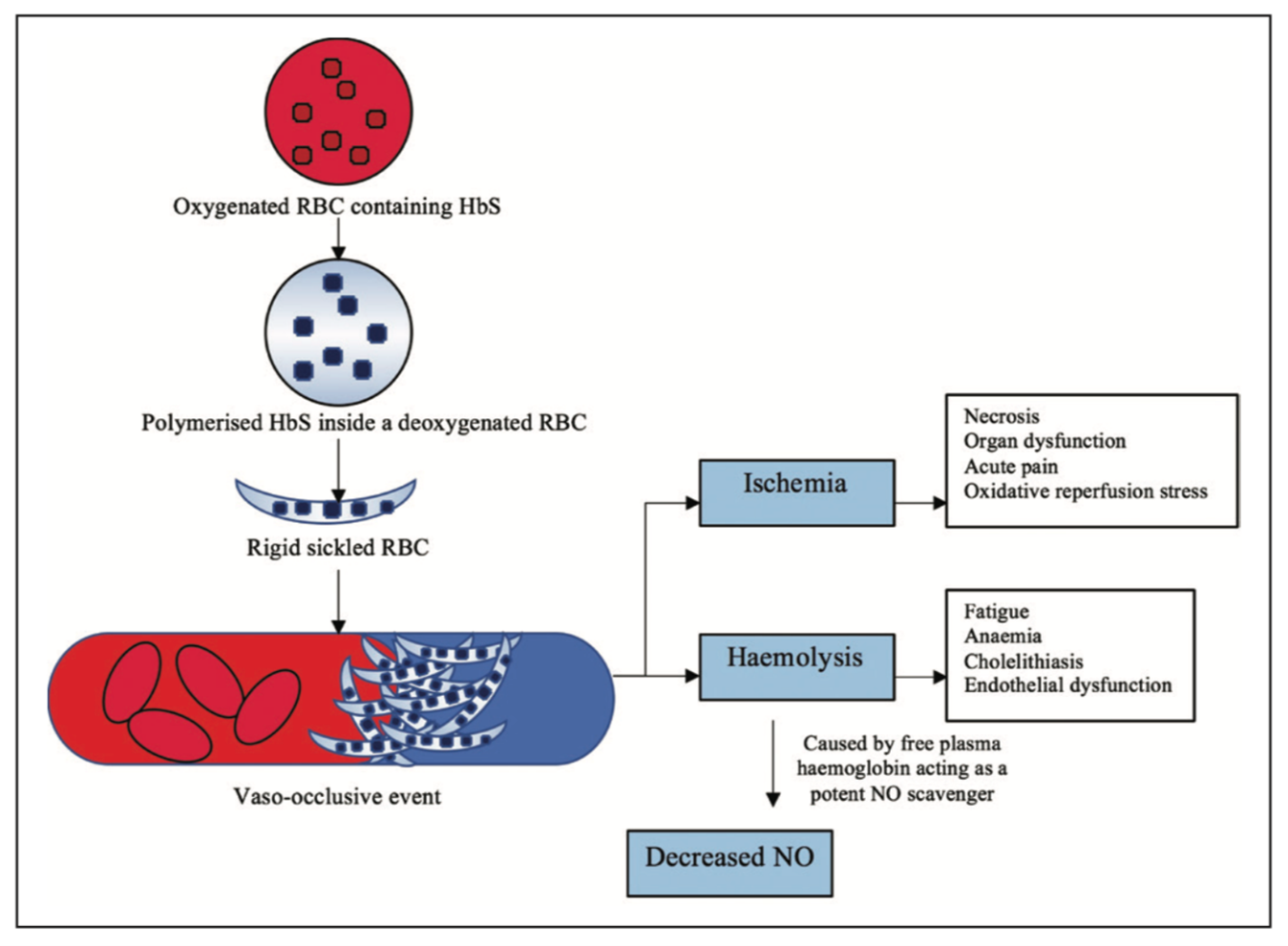 turning-back-the-sickle-cell-disease-a-new-drug-into-play-drug-can